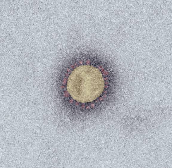 SARS-Coronavirus-2. Quelle: Robert Koch-Institut © Robert Koch-Institut