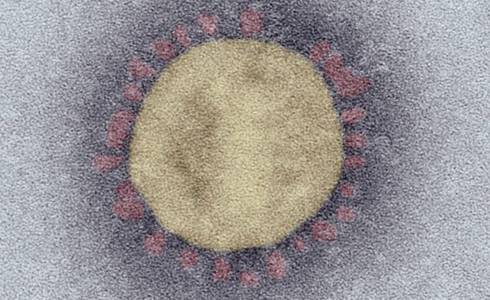 SARS-Coronavirus-2. Quelle: Robert Koch-Institut © Robert Koch-Institut